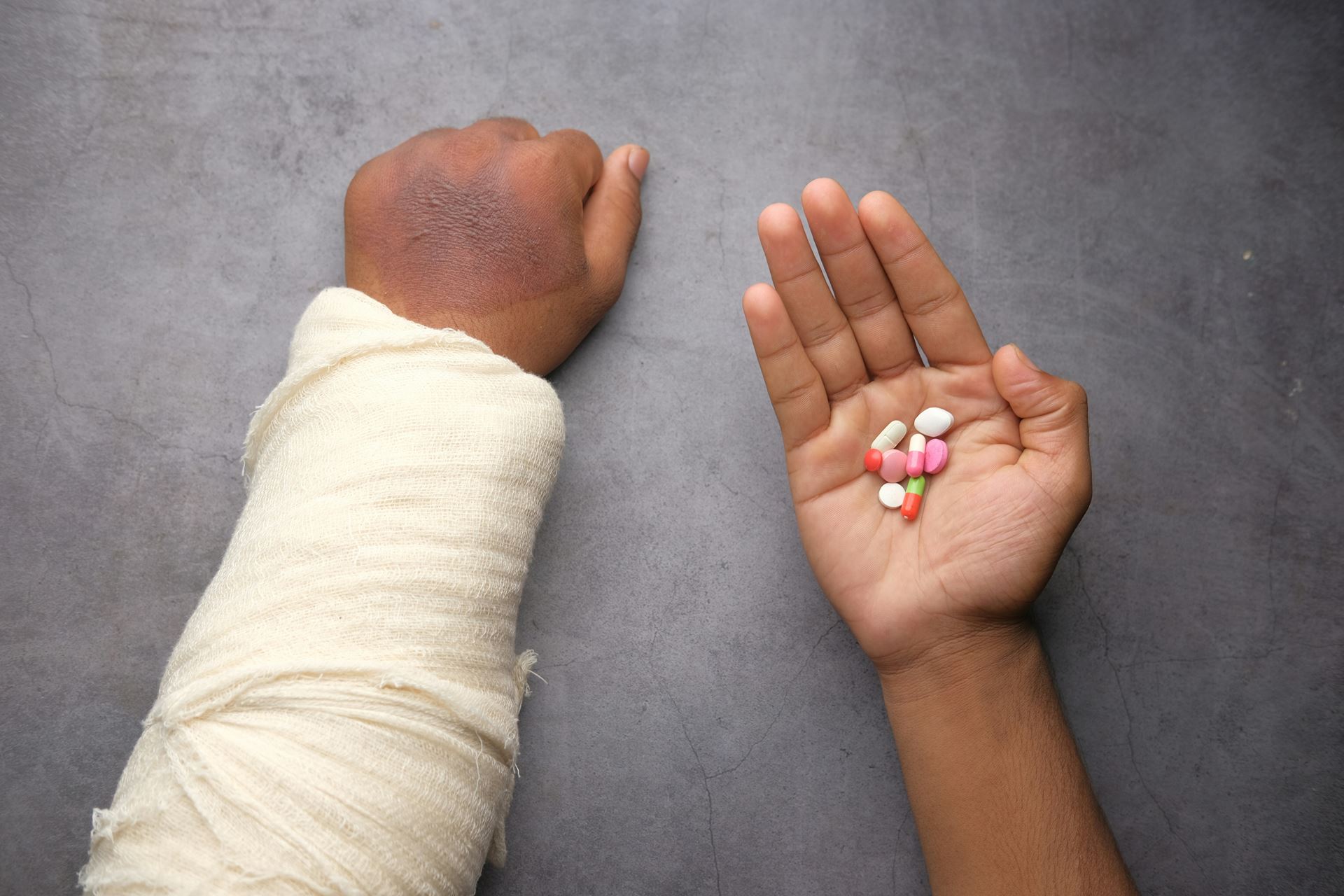 a person with a bandaged left arm, holding pain killers in his right